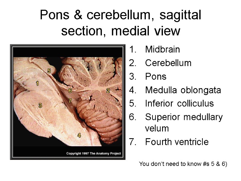 Pons & cerebellum, sagittal section, medial view Midbrain  Cerebellum  Pons  Medulla